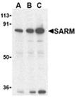 SARM polyclonal antibody Western blot