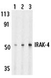 IRAK-4 polyclonal antibody Western blot