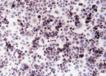MVP/LRP (human) monoclonal antibody (LRP-56) image