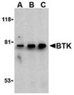 BTK polyclonal antibody Western blot
