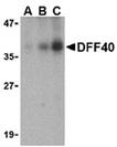 DFF40/CAD (IN) polyclonal antibody Western blot