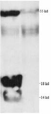 Acetylated Lysine polyclonal antibody (biotin conjugate) Western blot