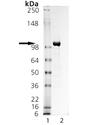 LRRC32 (human):Fc (human), (recombinant) SDS-PAGE