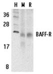 BAFF receptor (CT) BR3 polyclonal antibody Western blot