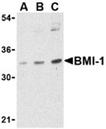 BMI-1 polyclonal antibody Western blot