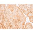 GLUT1 monoclonal antibody (2475) IHC bladder