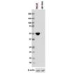 Cytokeratin 14 polyclonal antibody WB